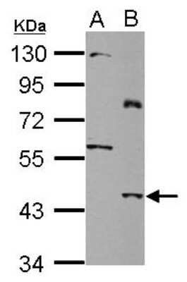 Western Blot: SLC25A46 Antibody [NBP2-20392] - Sample (30 ug of whole cell lysate) A: HeLa B: HeLa membrane 10% SDS PAGE gel, diluted at 1:500.