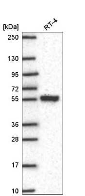 Western Blot: SLC25A46 Antibody [NBP2-57347] - Western blot analysis in human cell line RT-4.