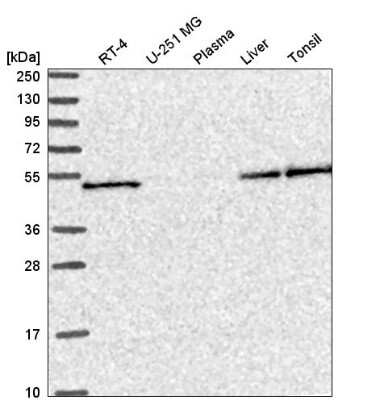 Western Blot: SLC25A46 Antibody [NBP2-58085] - Western blot analysis in human cell line RT-4, human cell line U-251 MG, human plasma, human liver tissue and human tonsil tissue.