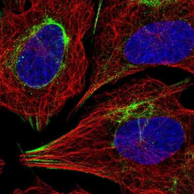 Immunocytochemistry/Immunofluorescence: SLC25A48 Antibody [NBP1-81893] - Immunofluorescent staining of human cell line U-2 OS shows localization to actin filaments & intermediate filaments.