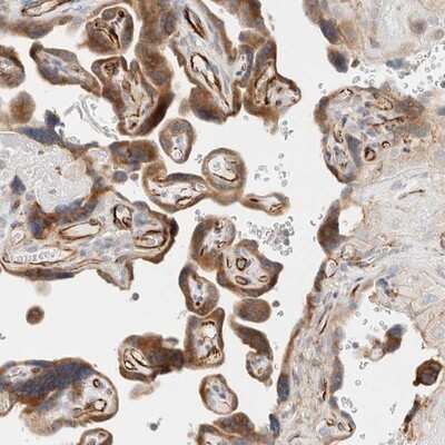 Immunohistochemistry-Paraffin: SLC25A48 Antibody [NBP1-81893] - Staining of human placenta shows distinct positivity in trophoblastic cells and endothelial cells.