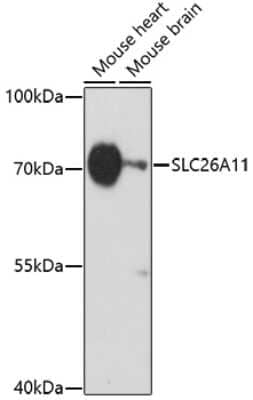 Western Blot: SLC26A11 Antibody [NBP2-93243] - Analysis of extracts of various cell lines, using SLC26A11 at 1:1000 dilution. Secondary antibody: HRP Goat Anti-Rabbit IgG (H+L) at 1:10000 dilution. Lysates/proteins: 25ug per lane. Blocking buffer: 3% nonfat dry milk in TBST. Detection: ECL Basic Kit . Exposure time: 60s.