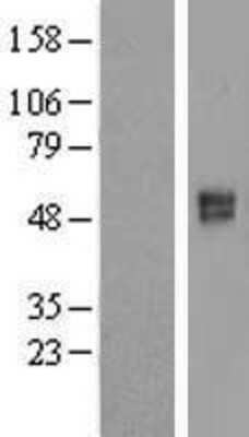 Western Blot: SLC26A11 Overexpression Lysate (Adult Normal) [NBL1-16075] Left-Empty vector transfected control cell lysate (HEK293 cell lysate); Right -Over-expression Lysate for SLC26A11.