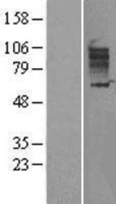 Western Blot: SLC26A3 Overexpression Lysate (Adult Normal) [NBL1-16077] Left-Empty vector transfected control cell lysate (HEK293 cell lysate); Right -Over-expression Lysate for SLC26A3.