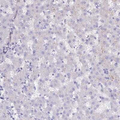 Immunohistochemistry-Paraffin: SLC26A4 Antibody [NBP1-85237] - Staining of human liver shows no positivity in hepatocytes as expected.