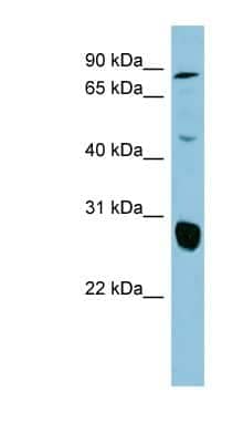 Western Blot SLC26A4 Antibody