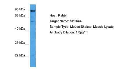 Western Blot SLC26A4 Antibody