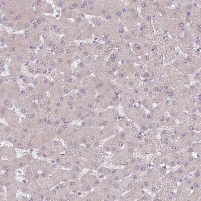 Immunohistochemistry-Paraffin: SLC26A6 Antibody [NBP2-47273] - Staining of human liver shows no positivity in hepatocytes as expected.