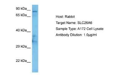 Western Blot: SLC26A6 Antibody [NBP2-88293] - Host: Rabbit. Target Name: SLC26A6. Sample Tissue: Human A172 Whole Cell lysates. Antibody Dilution: 1ug/ml