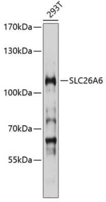 Western Blot: SLC26A6 Antibody [NBP2-93440] - Analysis of extracts of 293T cells, using SLC26A6 at 1:1000 dilution.Secondary antibody: HRP Goat Anti-Rabbit IgG (H+L) at 1:10000 dilution.Lysates/proteins: 25ug per lane.Blocking buffer: 3% nonfat dry milk in TBST.Detection: ECL Basic Kit .Exposure time