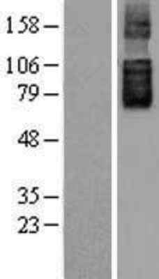 Western Blot: SLC26A6 Overexpression Lysate (Adult Normal) [NBL1-16078] Left-Empty vector transfected control cell lysate (HEK293 cell lysate); Right -Over-expression Lysate for SLC26A6.