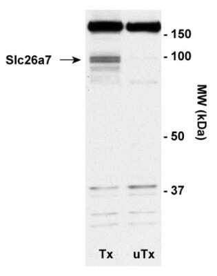 Western Blot: SLC26A7 Antibody (14H5) - Azide and BSA Free [NBP2-80950] - Detection of Slc26a7 using NB110-60965. Tx: Okp cells transiently transfected with mouse Slc26a7 UTX: untransfected Okp cells. Image from the standard format of this antibody.