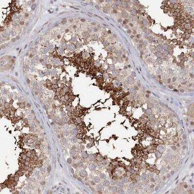 <b>Orthogonal Strategies Validation. </b>Immunohistochemistry: SLC26A8 Antibody [NBP1-87419] - Staining of human testis shows strong cytoplasmic and moderate nuclear positivity in cells in seminiferous ducts.