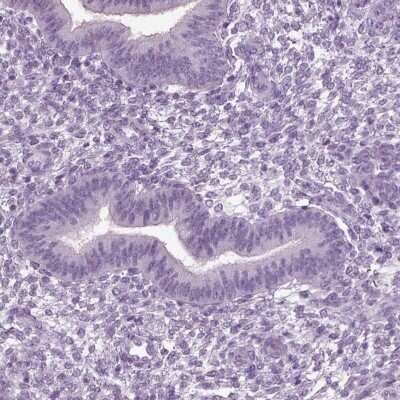 Immunohistochemistry-Paraffin: SLC26A8 Antibody [NBP1-87419] - Staining of human endometrium shows low expression as expected.