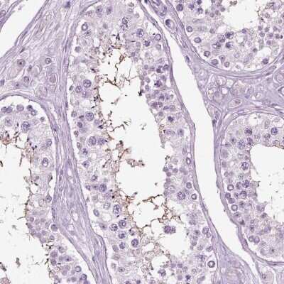 Immunohistochemistry-Paraffin: SLC26A8 Antibody [NBP1-87419] - Staining of human testis shows high expression.