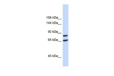 Western Blot: SLC26A8 Antibody [NBP2-85747] - Host: Rabbit. Target Name: SLC26A8. Sample Type: 293T Whole Cell lysates. Antibody Dilution: 1.0ug/ml