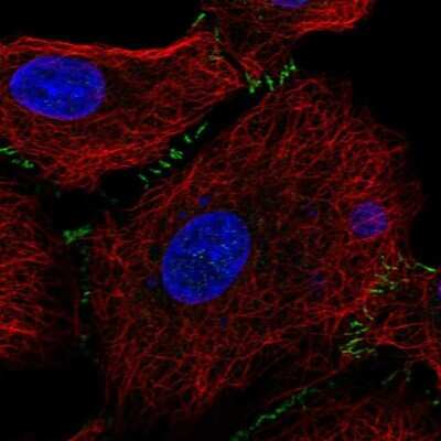 Immunocytochemistry/Immunofluorescence: SLC26A9 Antibody [NBP2-30425] - Staining of human cell line A549 shows localization to cell junctions. Antibody staining is shown in green.