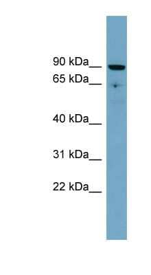 Western Blot: SLC26A9 Antibody [NBP1-59514] - PANC1 cell lysate, concentration 0.2-1 ug/ml.