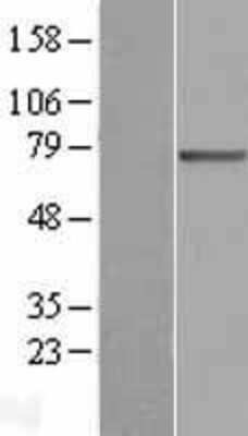 Western Blot: SLC27A3 Overexpression Lysate (Adult Normal) [NBL1-16081] Left-Empty vector transfected control cell lysate (HEK293 cell lysate); Right -Over-expression Lysate for SLC27A3.