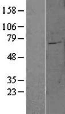 Western Blot: SLC27A6 Overexpression Lysate (Adult Normal) [NBL1-16083] Left-Empty vector transfected control cell lysate (HEK293 cell lysate); Right -Over-expression Lysate for SLC27A6.