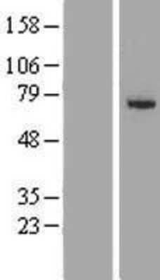 Western Blot: SLC27A6 Overexpression Lysate (Adult Normal) [NBL1-16084] Left-Empty vector transfected control cell lysate (HEK293 cell lysate); Right -Over-expression Lysate for SLC27A6.