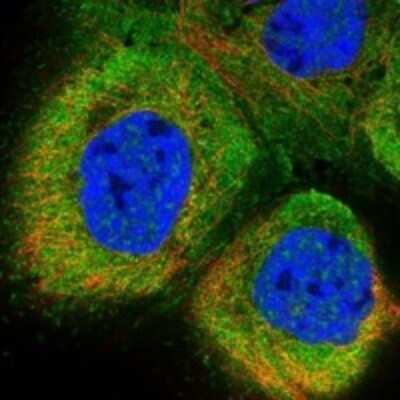 Immunocytochemistry/Immunofluorescence: SLC28A1 Antibody [NBP3-17620] - Staining of human cell line A-431 shows localization to nuclear speckles, plasma membrane & cytosol.