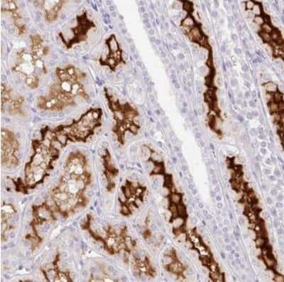 Immunohistochemistry-Paraffin: SLC28A1 Antibody [NBP2-30857] - Staining of human kidney shows membranous positivity in cells in tubules.