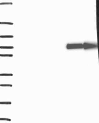 Western Blot: SLC28A1 Antibody [NBP3-17620] - Lane 1: Marker [kDa] 250, 130, 95, 72, 55, 36, 28, 17, 10;   Lane 2: RT4;   Lane 3: U-251 MG;   Lane 4: Human Plasma;   Lane 5: Liver;   Lane 6: Tonsil