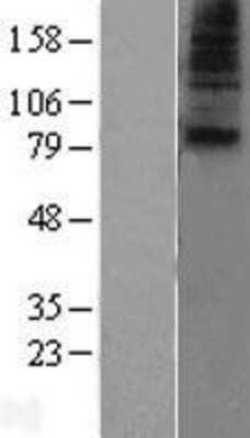 Western Blot: SLC28A1 Overexpression Lysate (Adult Normal) [NBL1-16085] Left-Empty vector transfected control cell lysate (HEK293 cell lysate); Right -Over-expression Lysate for SLC28A1.