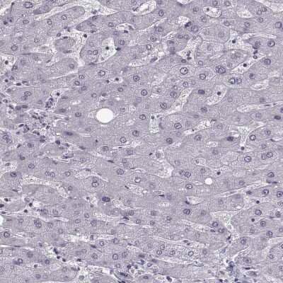 Immunohistochemistry-Paraffin: SLC28A2 Antibody [NBP2-33451] - Staining of human liver shows low expression as expected.