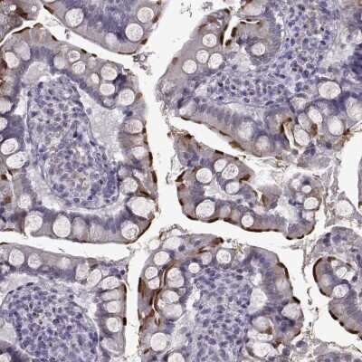 Immunohistochemistry-Paraffin: SLC28A2 Antibody [NBP2-33451] - Staining of human small intestine shows high expression.