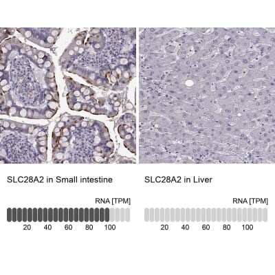 <b>Orthogonal Strategies Validation. </b>Immunohistochemistry-Paraffin: SLC28A2 Antibody [NBP2-33451] - Staining in human small intestine and liver tissues using anti-SLC28A2 antibody. Corresponding SLC28A2 RNA-seq data are presented for the same tissues.