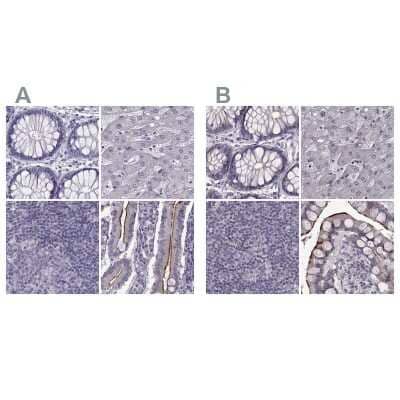 <b>Independent Antibodies Validation. </b>Immunohistochemistry-Paraffin: SLC28A2 Antibody [NBP2-33451] - Staining of human colon, liver, lymph node and small intestine using Anti-SLC28A2 antibody NBP2-33451 (A) shows similar protein distribution across tissues to independent antibody NBP2-38763 (B).