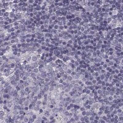 Immunohistochemistry-Paraffin: SLC28A2 Antibody [NBP2-33451] - Staining of human lymph node.