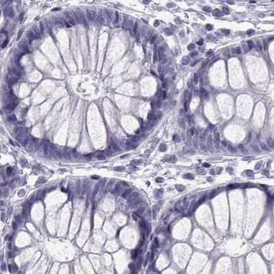 Immunohistochemistry-Paraffin: SLC28A2 Antibody [NBP2-33451] - Staining of human colon.