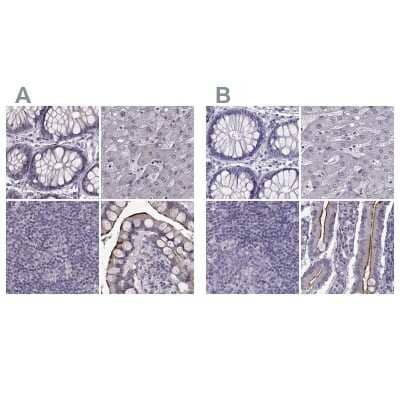 <b>Independent Antibodies Validation. </b>Immunohistochemistry-Paraffin: SLC28A2 Antibody [NBP2-38763] - Staining of human colon, liver, lymph node and small intestine using Anti-SLC28A2 antibody NBP2-38763 (A) shows similar protein distribution across tissues to independent antibody NBP2-33451 (B).