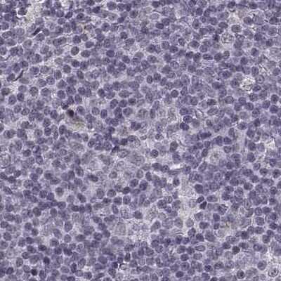 Immunohistochemistry-Paraffin: SLC28A2 Antibody [NBP2-38763] - Staining of human lymph node.