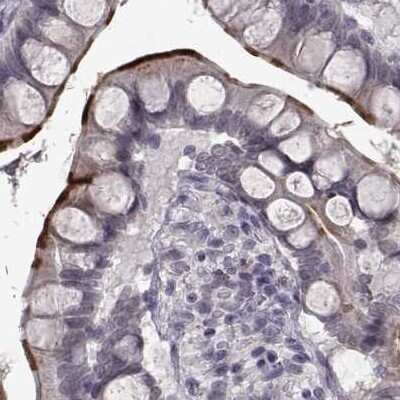 Immunohistochemistry-Paraffin: SLC28A2 Antibody [NBP2-38763] - Staining of human small intestine.