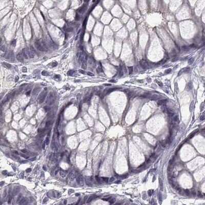 Immunohistochemistry-Paraffin: SLC28A2 Antibody [NBP2-38763] - Staining of human colon.