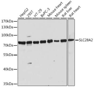 Western Blot: SLC28A2 Antibody [NBP2-93794] - Analysis of extracts of various cell lines, using SLC28A2 at 1:1000 dilution. Secondary antibody: HRP Goat Anti-Rabbit IgG (H+L) at 1:10000 dilution. Lysates/proteins: 25ug per lane. Blocking buffer: 3% nonfat dry milk in TBST. Detection: ECL Basic Kit . Exposure time: 5s.