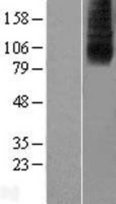 Western Blot: SLC28A2 Overexpression Lysate (Adult Normal) [NBL1-16086] Left-Empty vector transfected control cell lysate (HEK293 cell lysate); Right -Over-expression Lysate for SLC28A2.