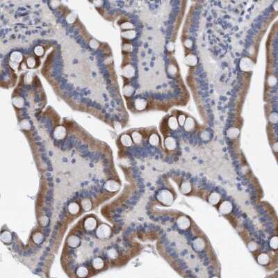 Immunohistochemistry-Paraffin: SLC28A3 Antibody [NBP1-84417] - Staining of human Duodenum shows moderate membranous and cytoplasmic positivity in glandular cells.