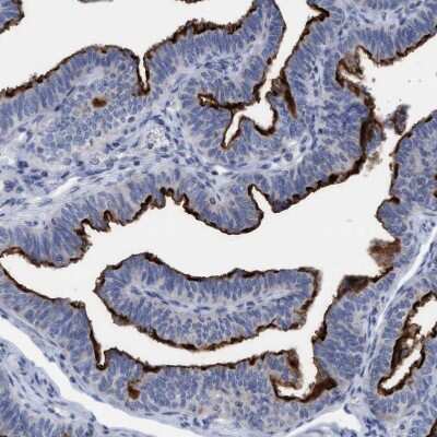 Immunohistochemistry-Paraffin: SLC28A3 Antibody [NBP1-84417] - Staining of human Fallopian tube shows strong membranous positivity in glandular cells.