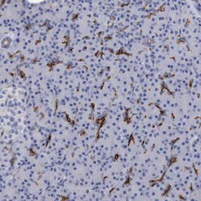 Immunohistochemistry-Paraffin: SLC28A3 Antibody [NBP1-84417] - Staining of human Pancreas shows moderate membranous and cytoplasmic positivity in exocrine glandular cells.