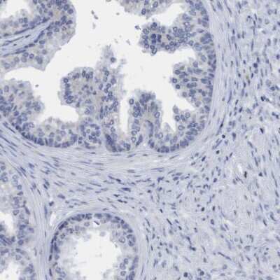 Immunohistochemistry-Paraffin: SLC28A3 Antibody [NBP1-84417] - Staining of human Prostate shows no positivity in glandular cells.