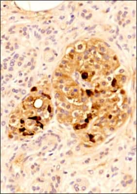 Immunohistochemistry-Paraffin: SLC28A3 Antibody [NBP2-29615] - IHC analysis of a formalin fixed and paraffin embedded tissue section of human pancreas using SLC28A3 antibody at 1:200 dilution. The antibody generated an expected cytoplasmic staining and the expression was mainly seen in Islet of Langerhans while the pancreatic acinar cells showed very weak staining. Inside the Islet of Langerhans, the alpha and beta cells showed moderate to high staining while the delta cells depicted very intense staining for SLC28A3 protein.