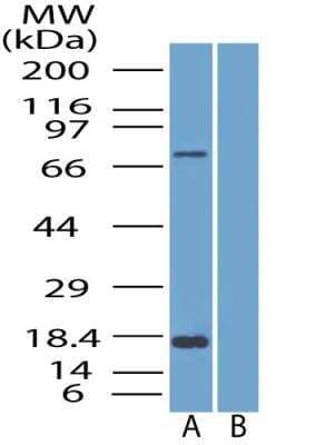 Western Blot: SLC28A3 Antibody [NBP2-29615] - Western blot analysis of SLC28A3 in A. PC3 cell lysate B. PC3 lysate with blocking peptide.