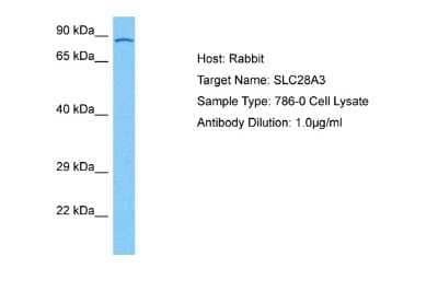 Western Blot: SLC28A3 Antibody [NBP2-88294] - Host: Rabbit. Target Name: SLC28A3. Sample Tissue: Human 786-0 Whole Cell lysates. Antibody Dilution: 1ug/ml