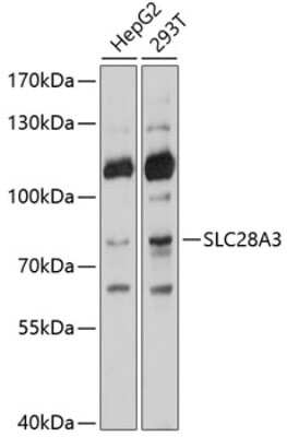 Western Blot: SLC28A3 Antibody [NBP2-93439] - Analysis of extracts of various cell lines, using SLC28A3 at 1:1000 dilution. Secondary antibody: HRP Goat Anti-Rabbit IgG (H+L) at 1:10000 dilution. Lysates/proteins: 25ug per lane. Blocking buffer: 3% nonfat dry milk in TBST. Detection: ECL Basic Kit . Exposure time: 1s.