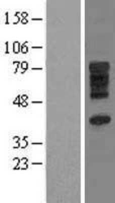 Western Blot: SLC28A3 Overexpression Lysate (Adult Normal) [NBL1-16087] Left-Empty vector transfected control cell lysate (HEK293 cell lysate); Right -Over-expression Lysate for SLC28A3.